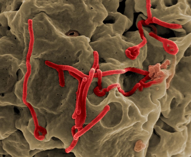 Nem valószínű, hogy Európában ebola-járvány alakul ki