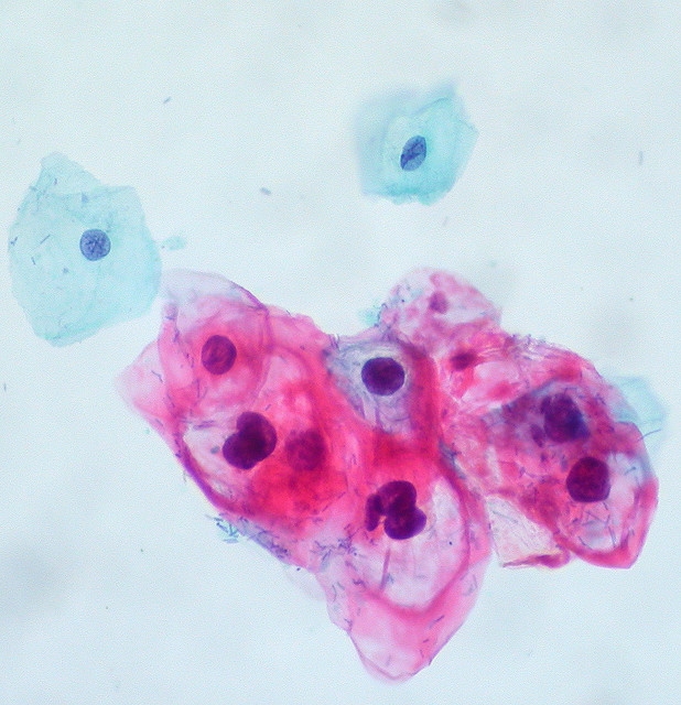 papilloma dermatológia paraziták fichorova plos egyet
