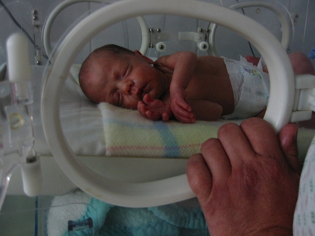 Veseelégtelenség: végre egy dialízis készülék csecsemőknek