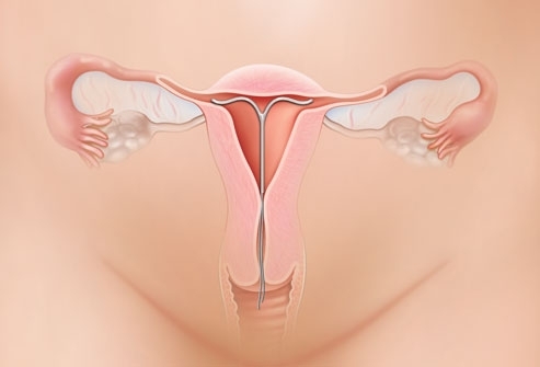 Mit jelent a hüvely és a külső nemi szervek gyulladása? Milyen tünetei vannak?