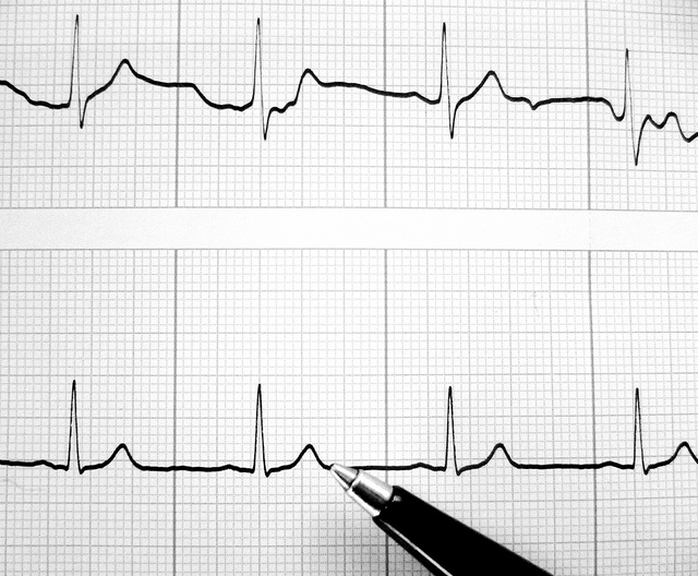 A táv-EKG-nak köszönhetően már a gyermekorvosok is bárhol elvégezhetnek akár életmentő vizsgálatokat