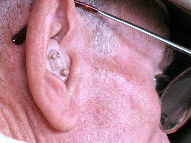 A hallókészülék megvédenek a memóriazavartól?