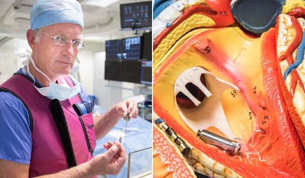 Először ültették be a legkisebbnek tartott pacemakert Nagy-Britanniában